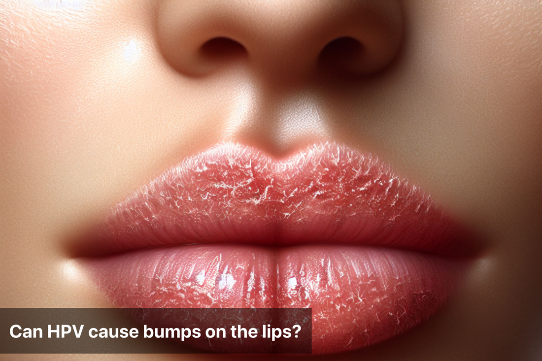 Close-up of lips illustrating the topic of HPV bumps