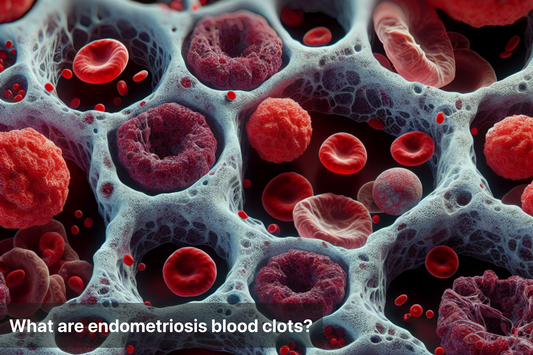 Microscopic view of endometriosis blood clots