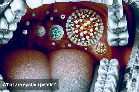 Illustration of Epstein pearls inside an infant's mouth