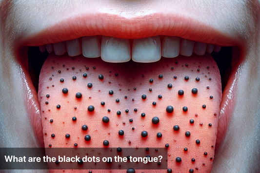 Close-up of a tongue with black dots and spots