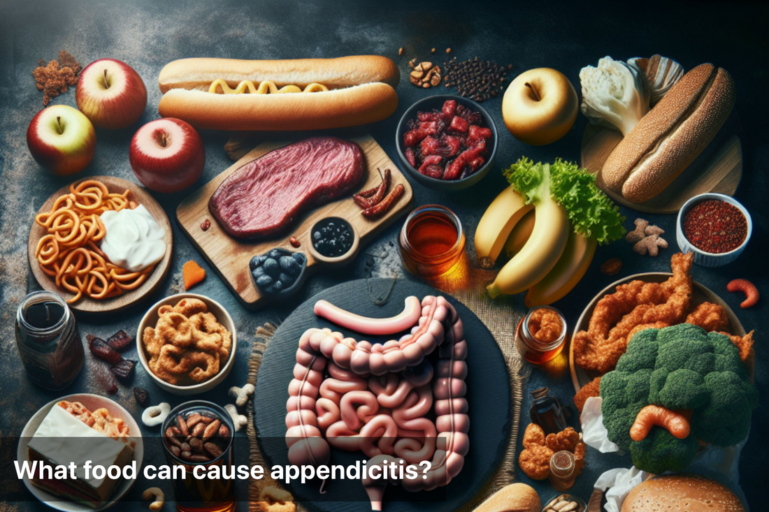 An assortment of foods, some linked to appendicitis risk.