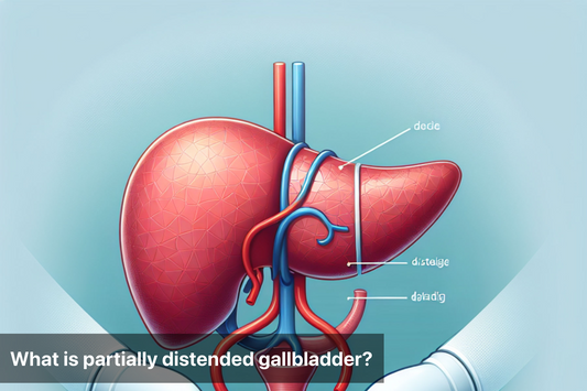 Illustration showing the anatomy of a partially distended gallbladder and associated organs.