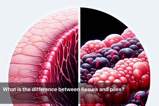 Illustration comparing anal fissure and piles differences.