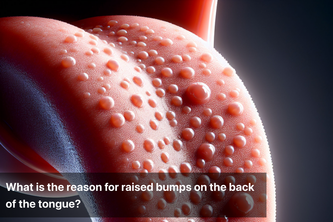 Close-up of raised pink bumps on the back of a human tongue